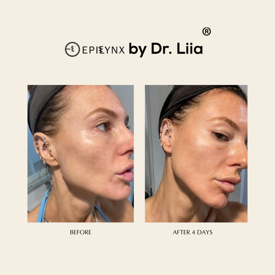 Pore Refining & Redness Relief Serum – Vegan, Gluten-Free, Hypoallergenic Brightening Formula