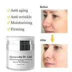 Wrinkle Repair Retinol Night Cream – Vegan, Gluten-Free, Regenerating Anti-Aging Moisturizer